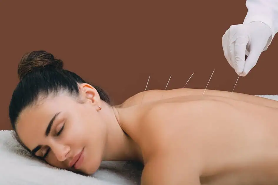 Dry Needling Therapy in Tallahassee, FL by Pathway Wellness