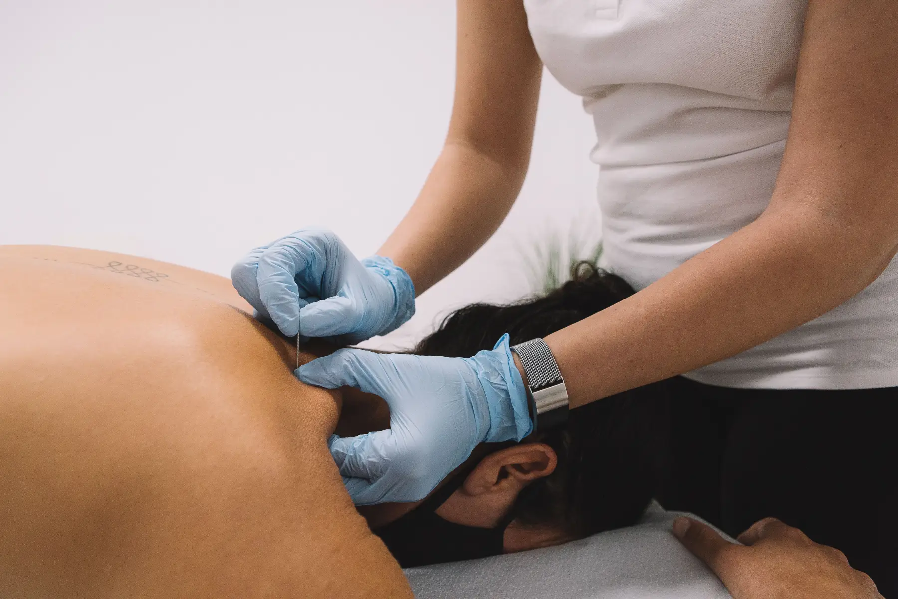 Dry Needling by Pathway Wellness in Tallahassee FL