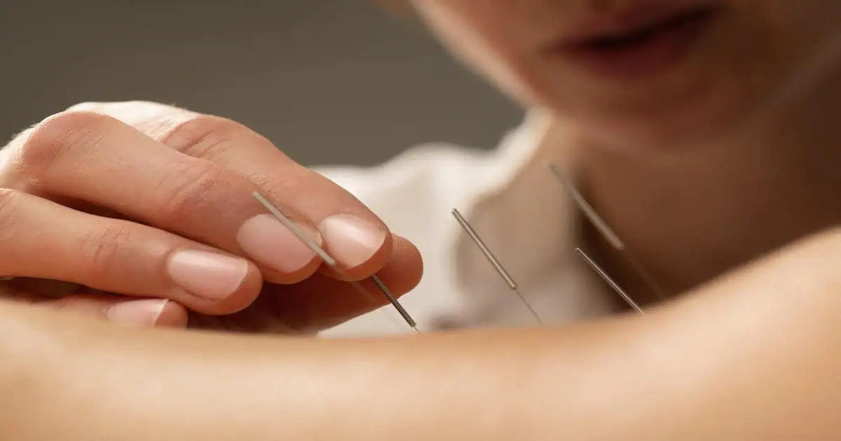 Dry Needling by Pathway Wellness in Tallahassee, FL